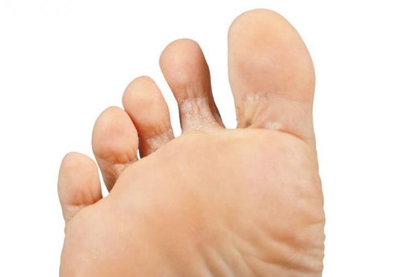 Recomendaciones SEFAC para prevenir y tratar los problemas más frecuentes en los pies