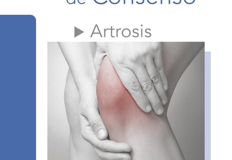 consenso artrosis
