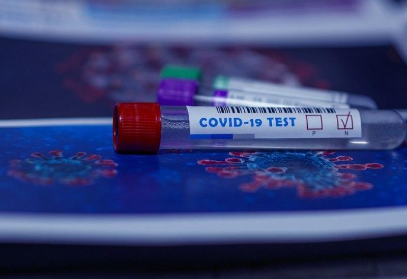 Sí a la dispensación de test de autodiagnóstico de COVID-19 para su realización en la farmacia asegurando la trazabilidad, control e interpretación de su resultado, al tratarse de una enfermedad infecciosa de declaración obligatoria