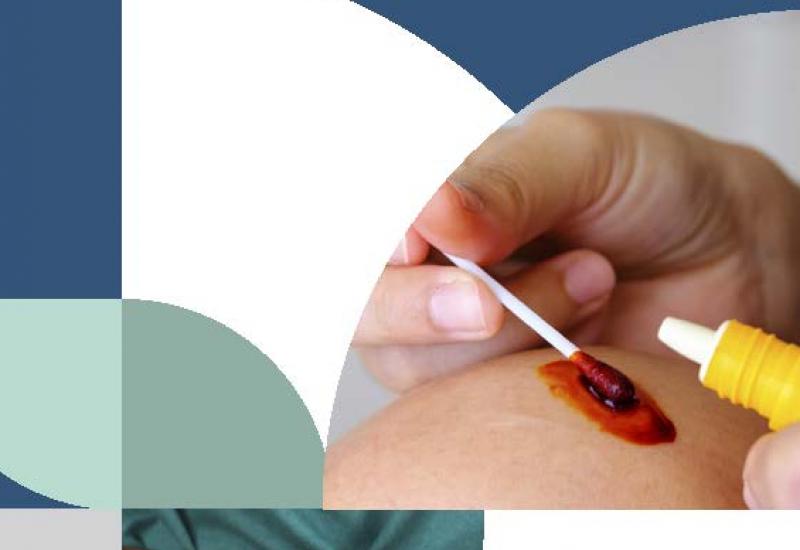 Guía de antisepsia, heridas y quemaduras