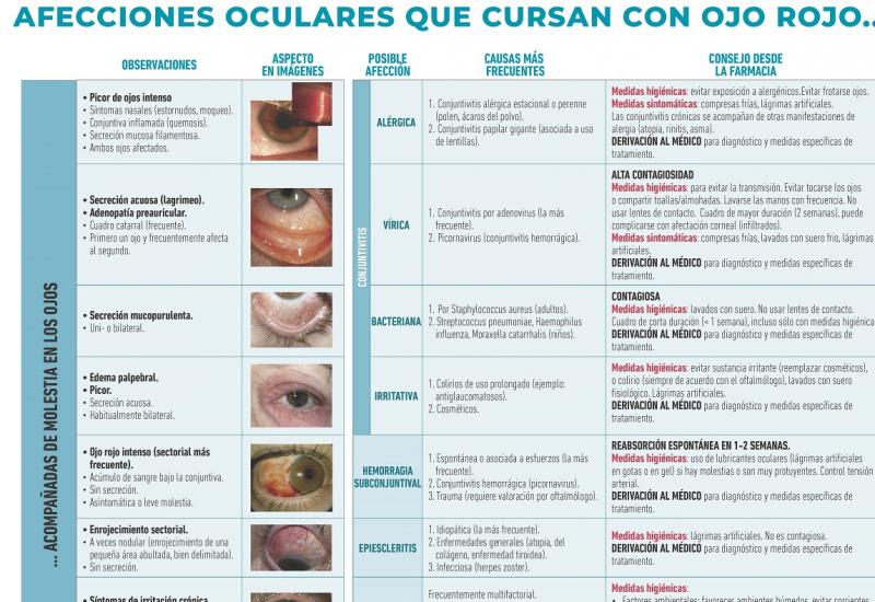 Infografía: Afecciones oculares que cursan con ojo rojo