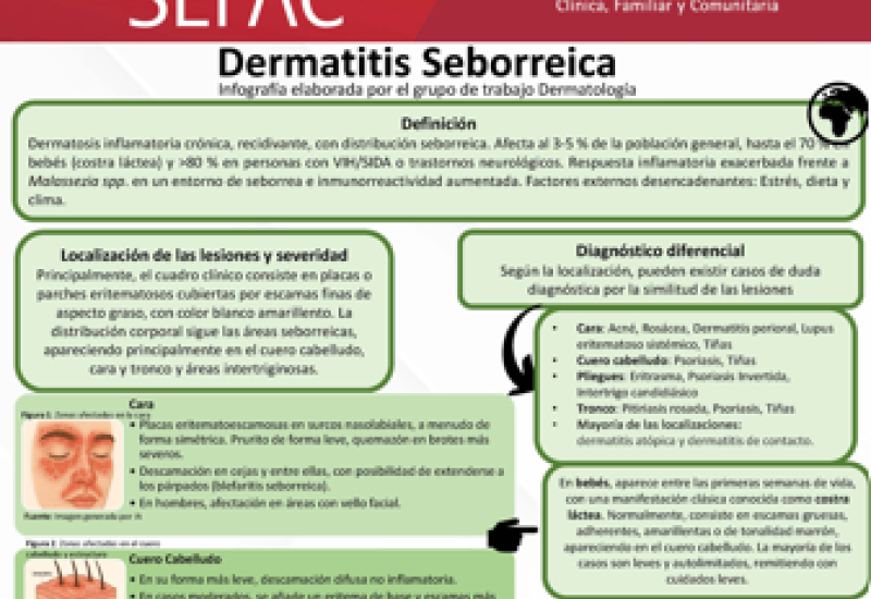 Dermatitis Seborreica